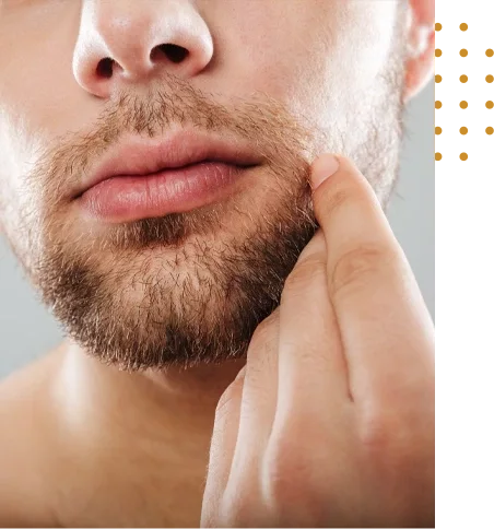 Greffe barbe prix Tunisie