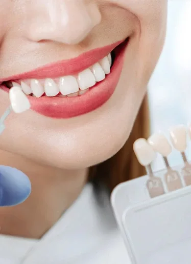 facette dentaire composite en Tunisie