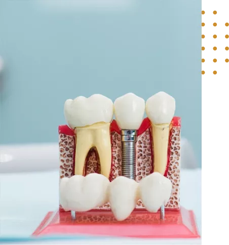 Prothèse dentaire prix Tunisie