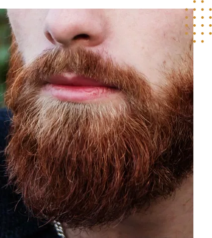 Greffe de barbe en Tunisie